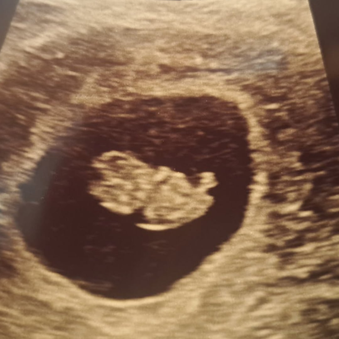 Photo shared by Sarah for their Babylist baby registry.