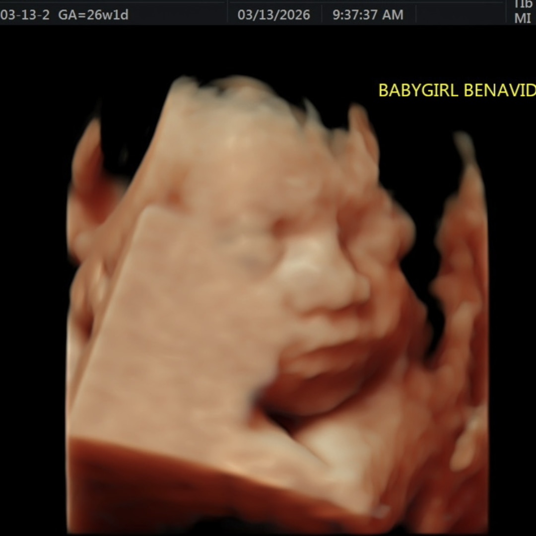 Photo shared by Brianna for their Babylist baby registry.