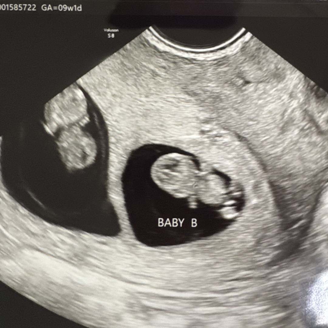 Photo shared by Karly for their Babylist baby registry.