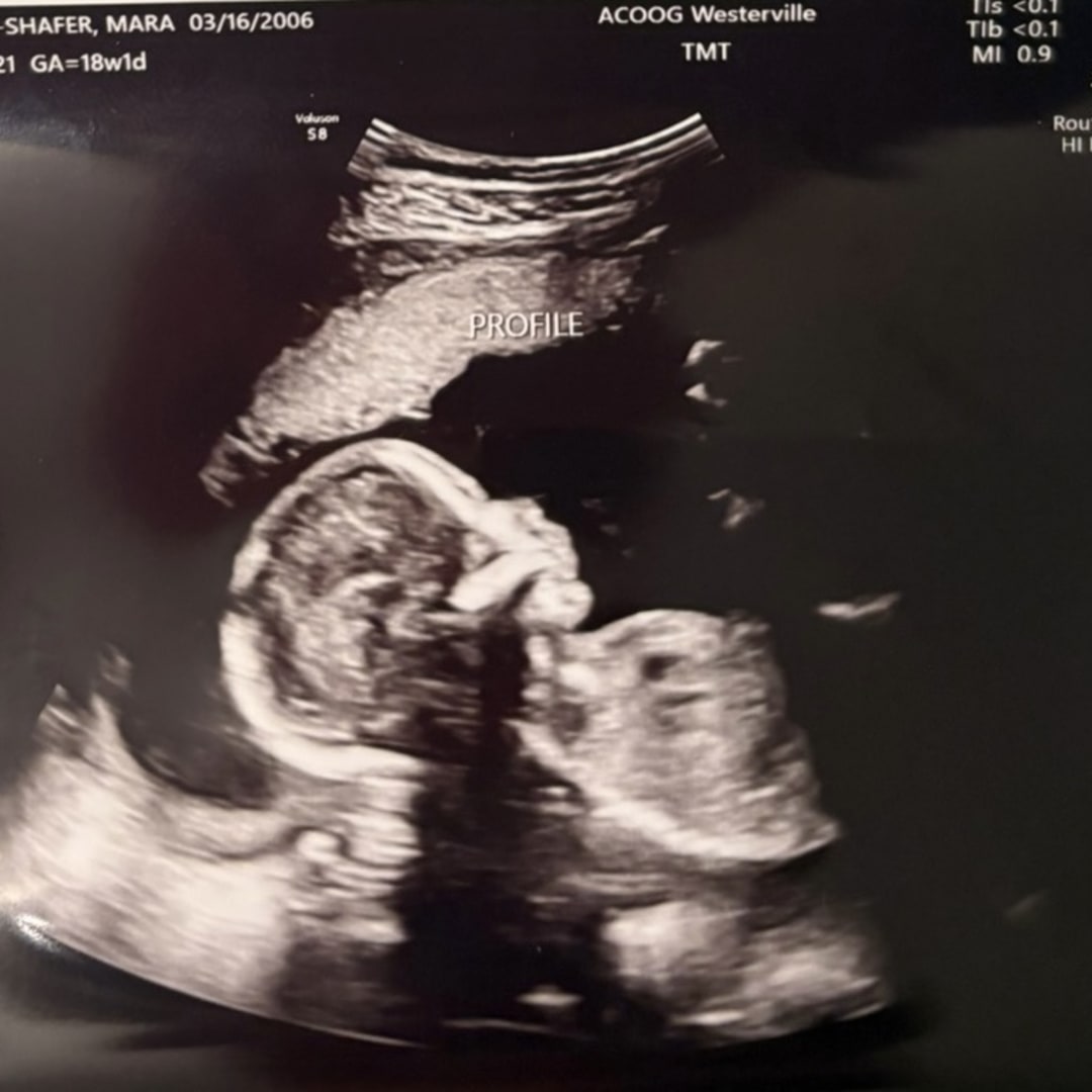 Photo shared by Mara for their Babylist baby registry.