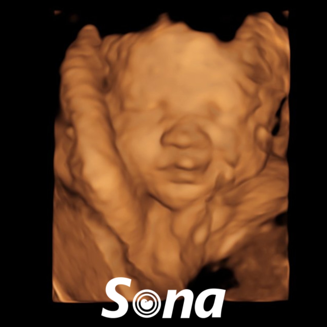 Photo shared by Ave for their Babylist baby registry.