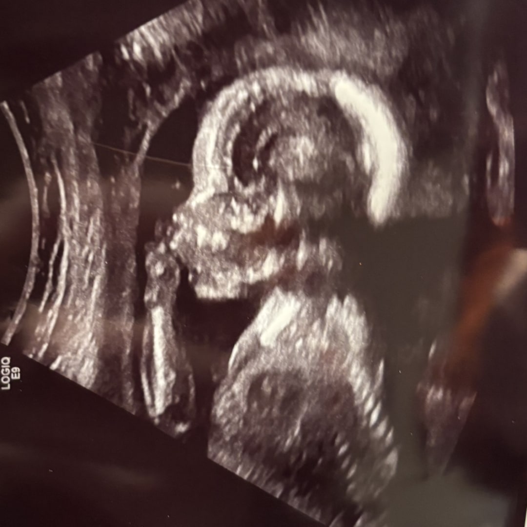 Photo shared by Emma for their Babylist baby registry.