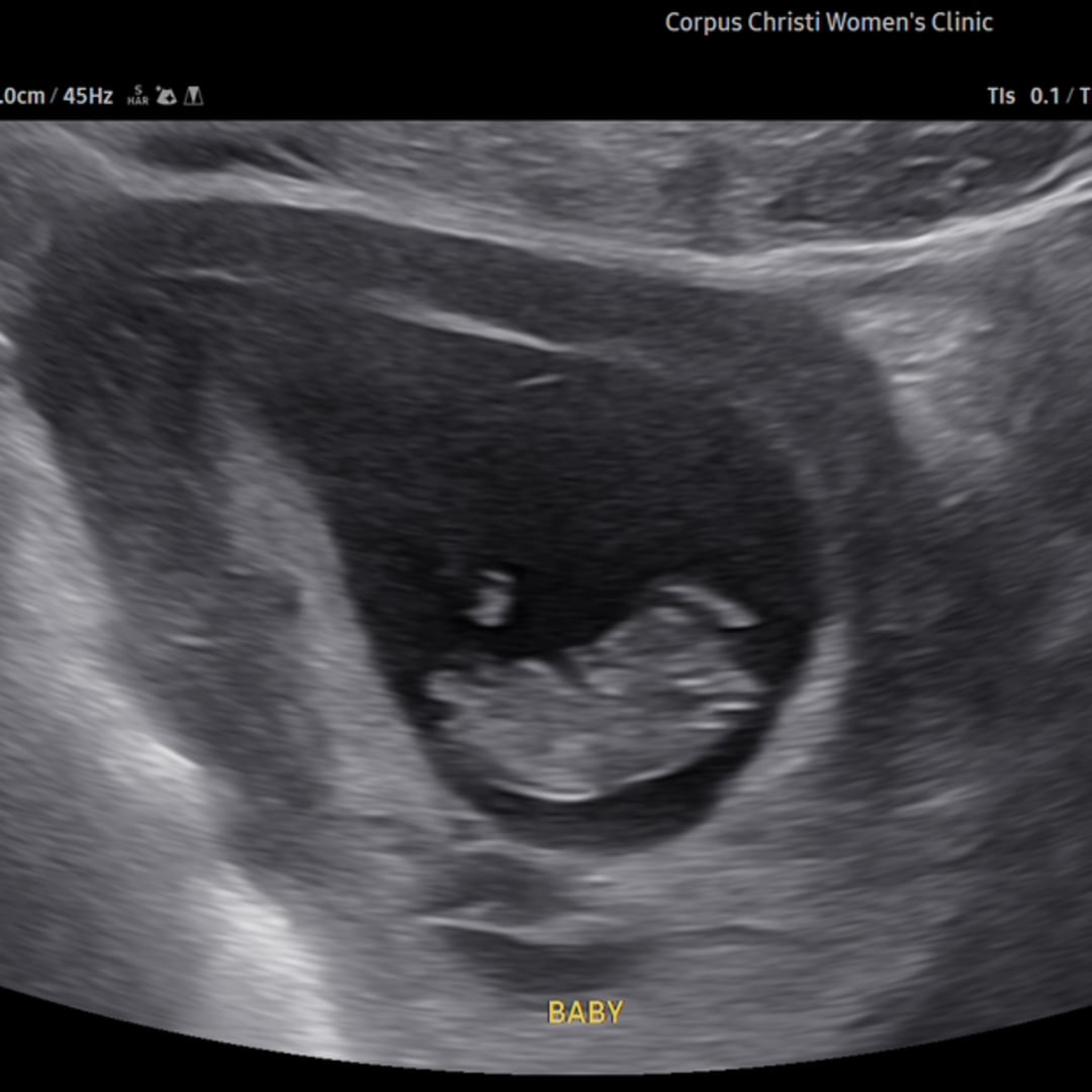 Photo shared by Mackenzie for their Babylist baby registry.