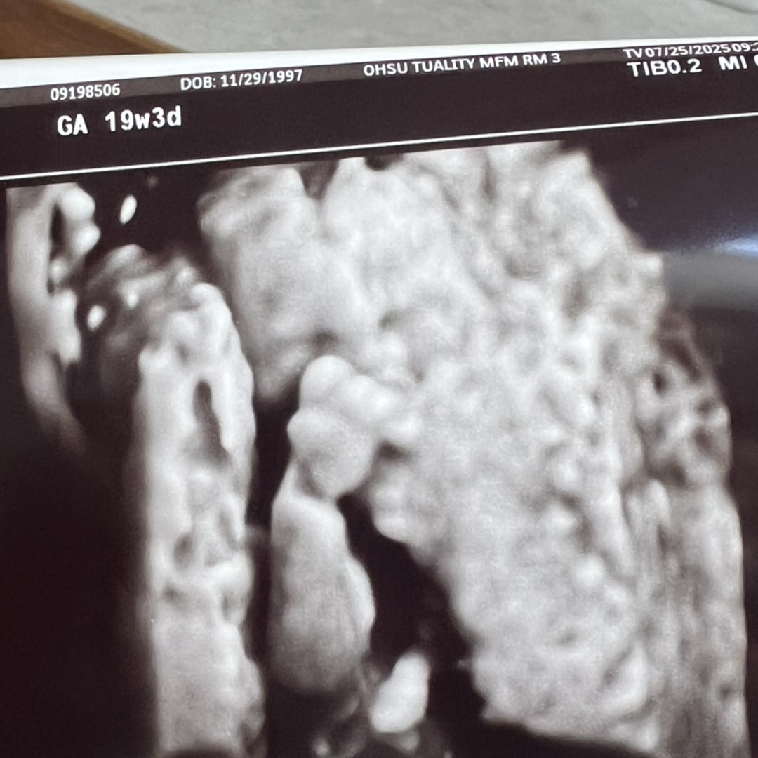 Photo shared by Heather for their Babylist baby registry.