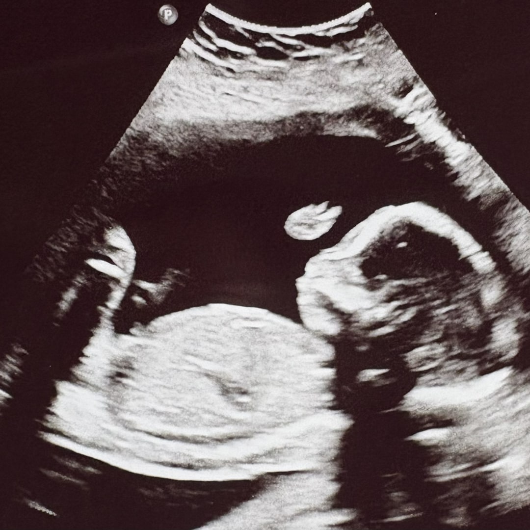 Photo shared by Stephanie for their Babylist baby registry.