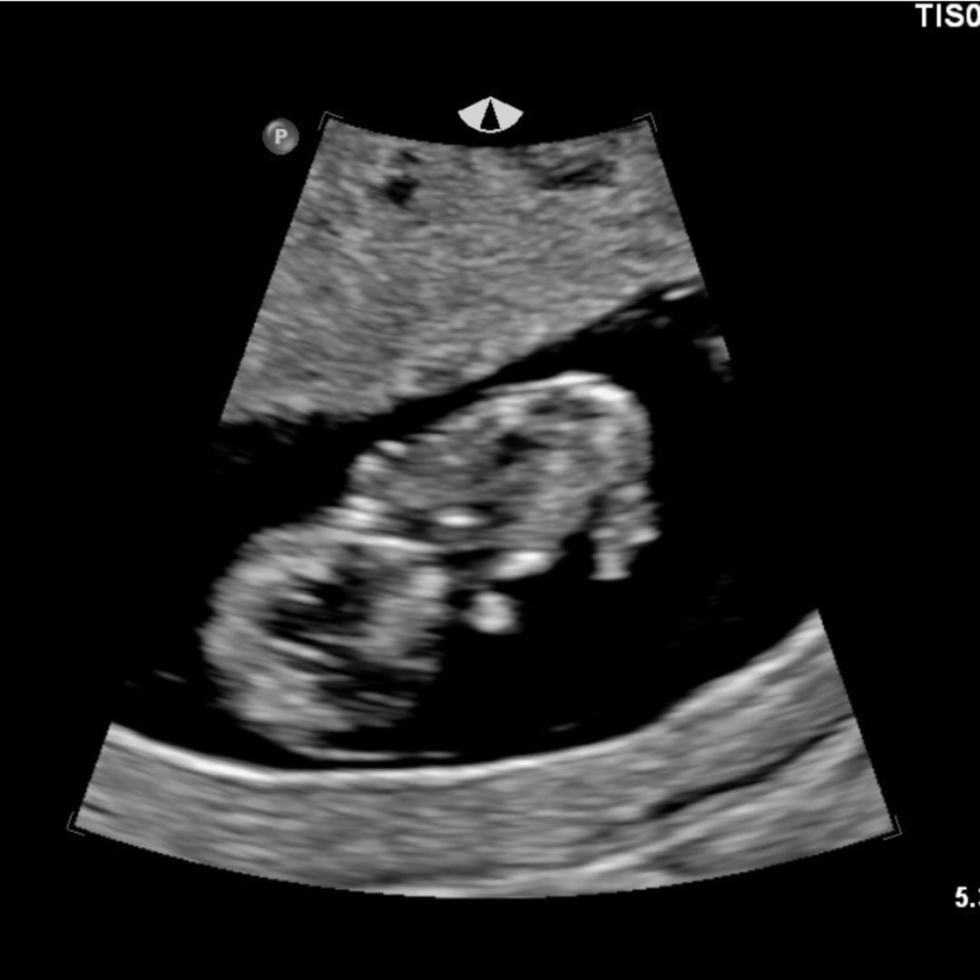 Photo shared by Cylie for their Babylist baby registry.