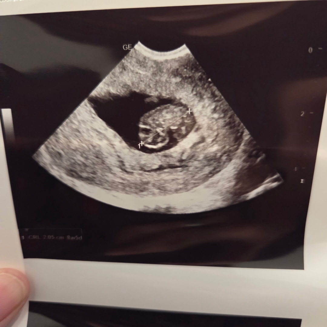 Photo shared by Mitzi for their Babylist baby registry.