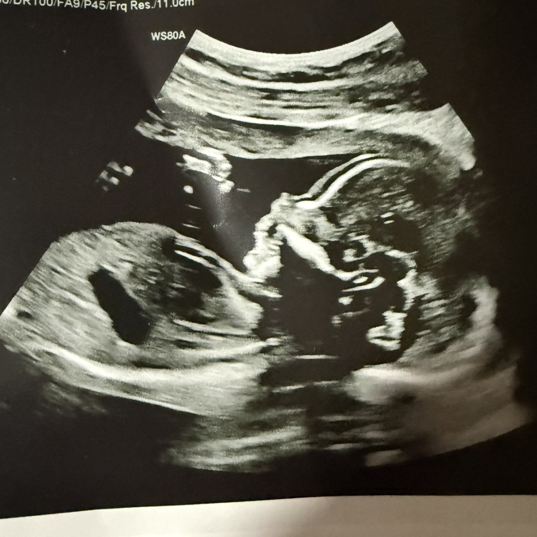 Photo shared by Daniela for their Babylist baby registry.