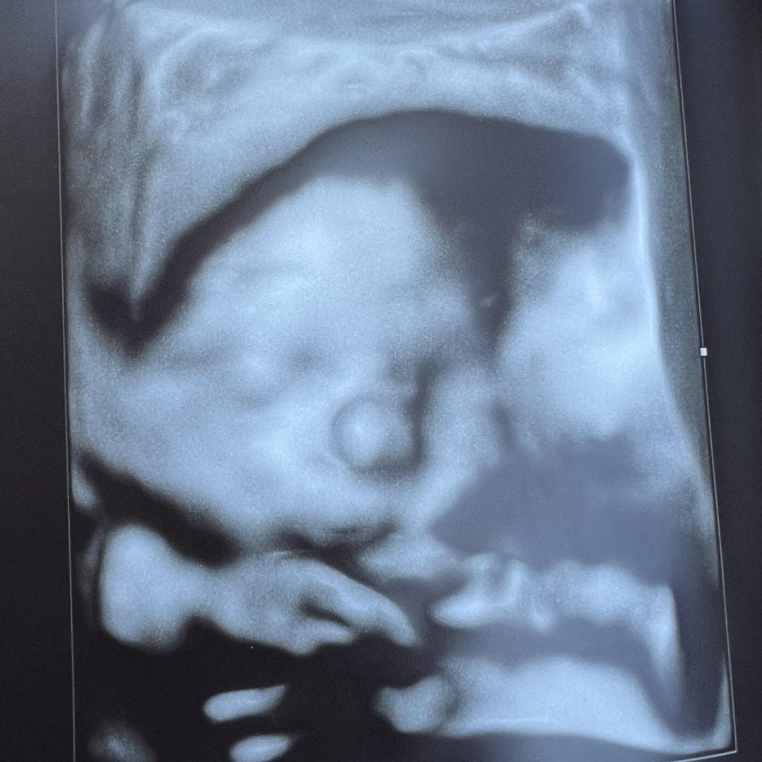 Photo shared by Danielle for their Babylist baby registry.