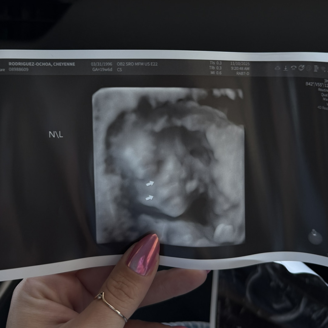 Photo shared by Cheyenne for their Babylist baby registry.