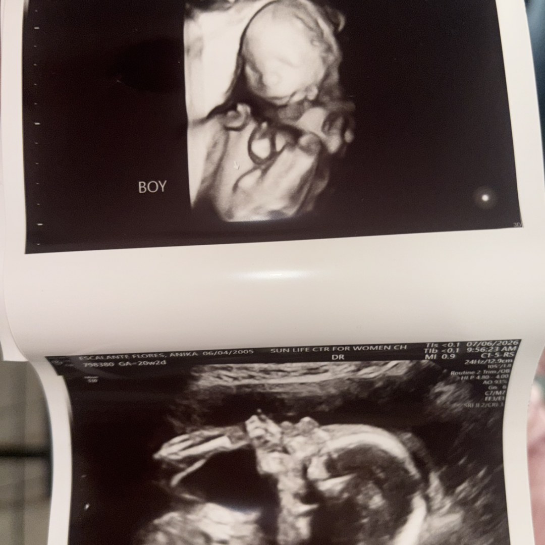 Photo shared by Anika for their Babylist baby registry.