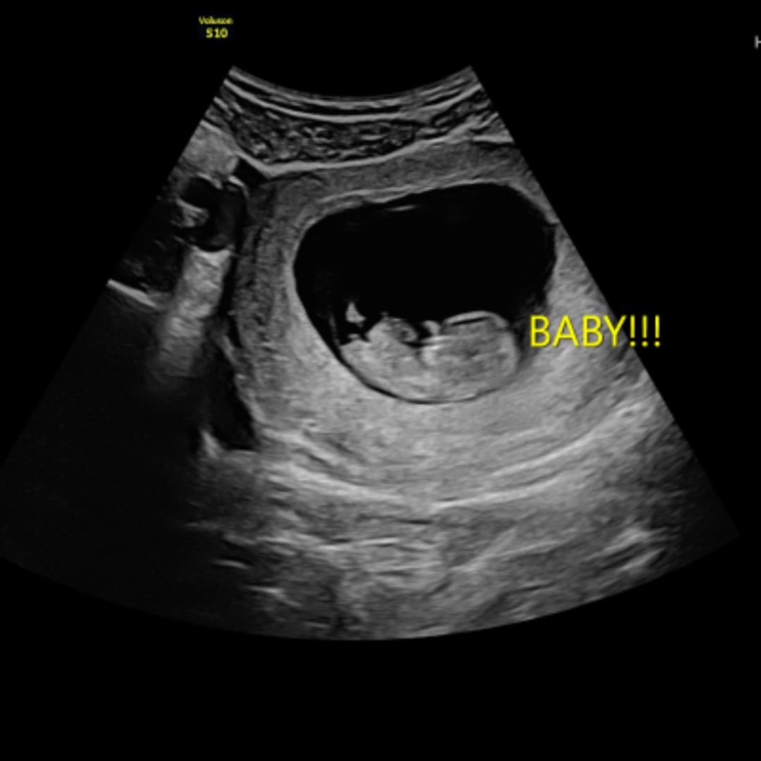 Photo shared by Ashley for their Babylist baby registry.