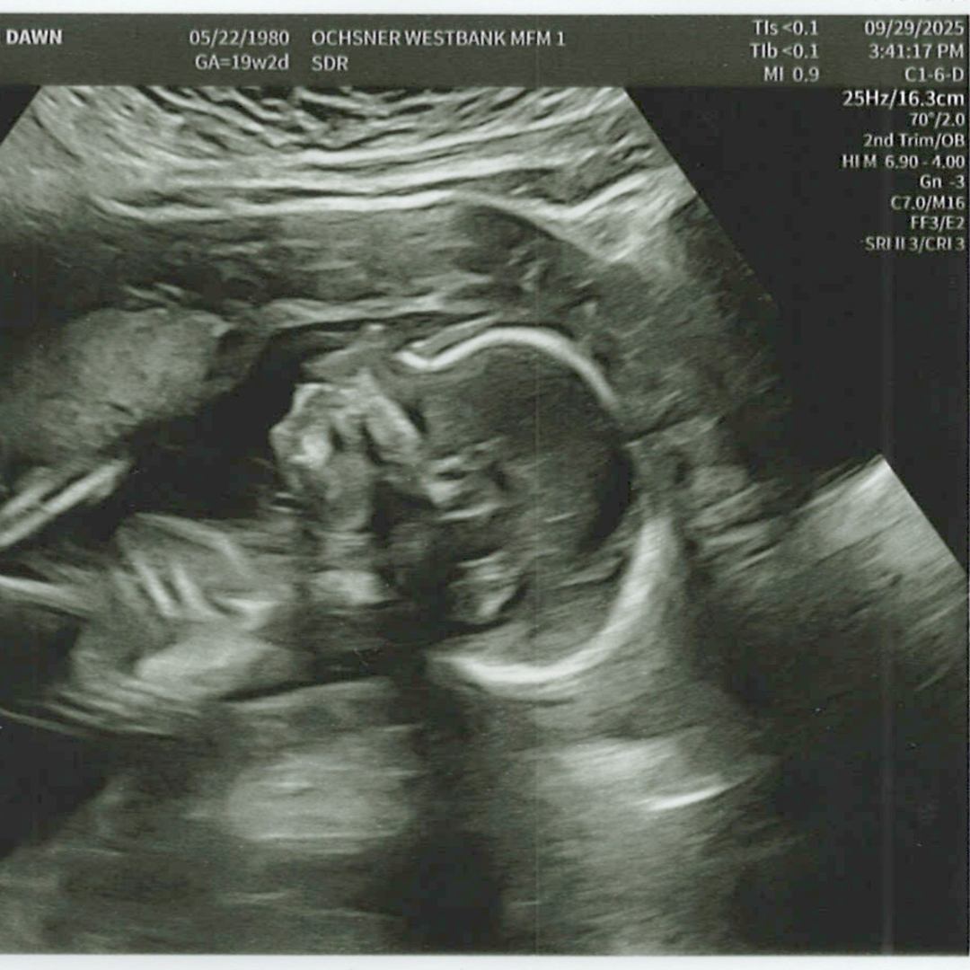 Photo shared by Rosalyn for their Babylist baby registry.