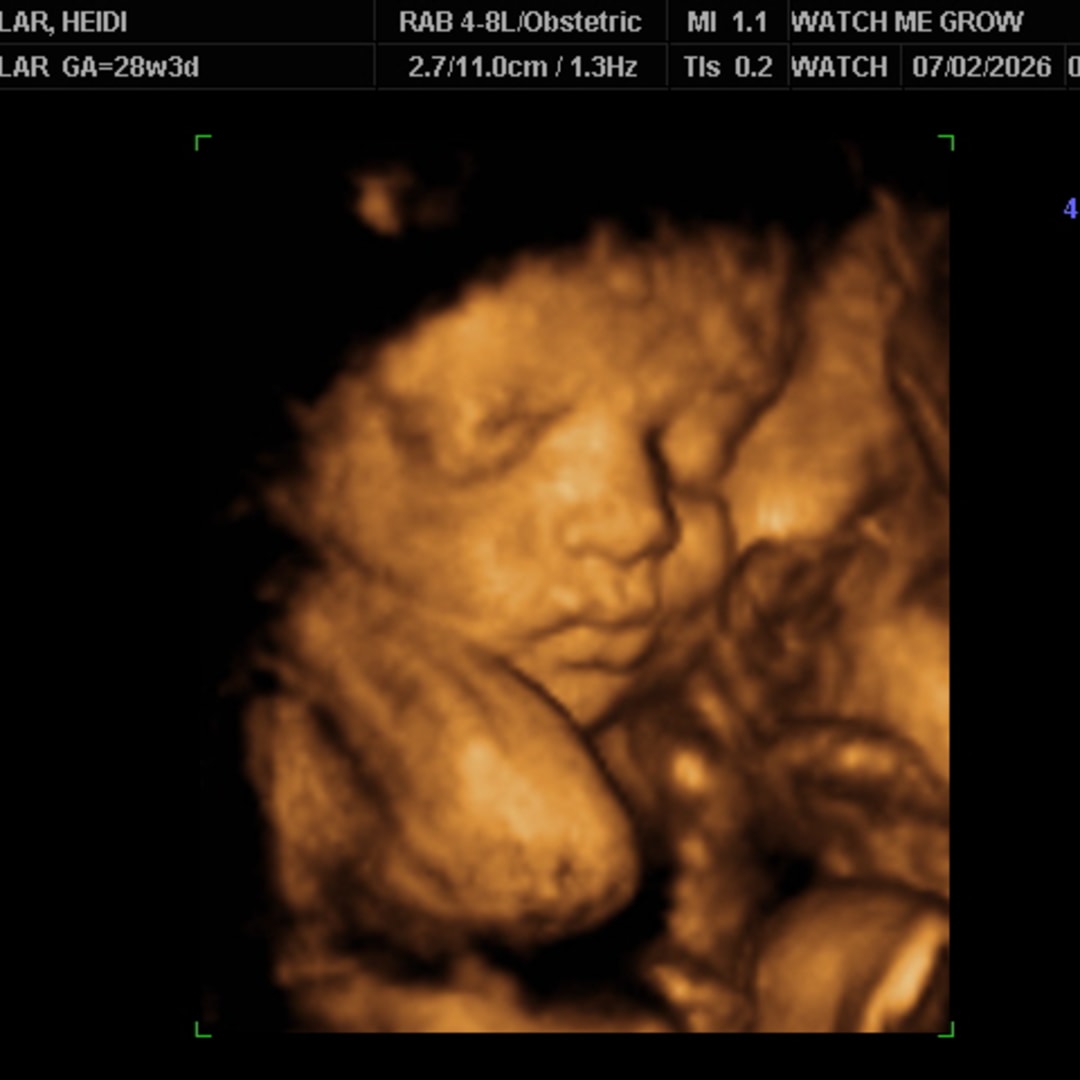 Photo shared by Heidi for their Babylist baby registry.