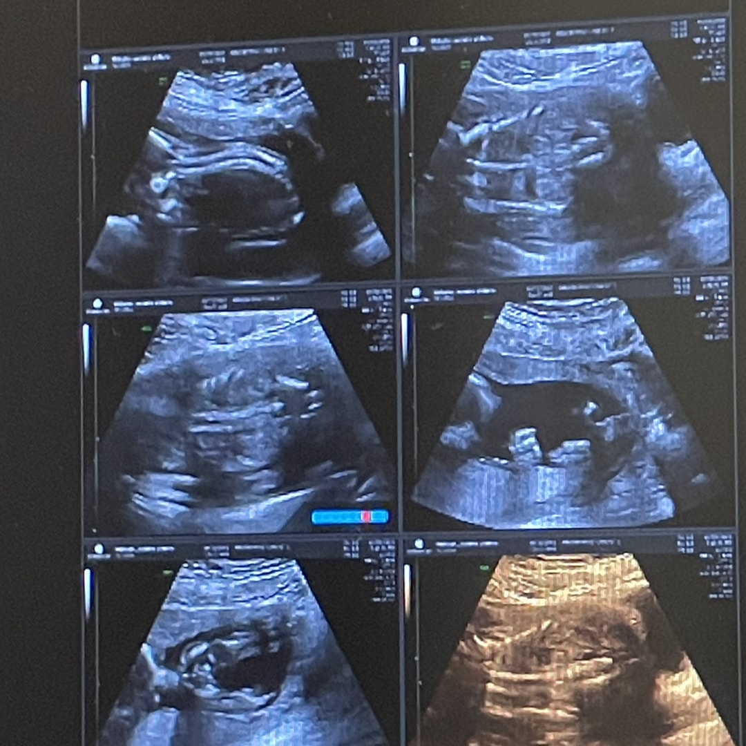 Photo shared by Jazmine for their Babylist baby registry.