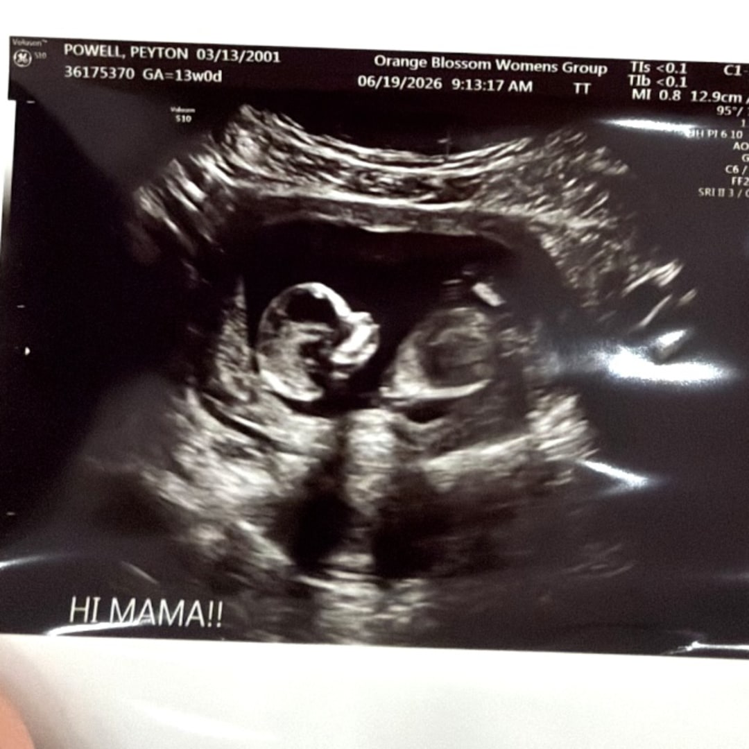 Photo shared by Peyton for their Babylist baby registry.