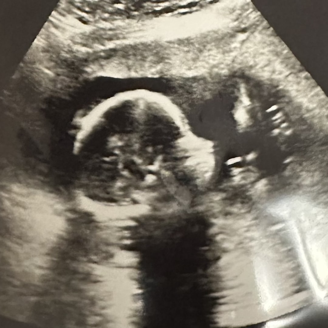 Photo shared by Jennifer for their Babylist baby registry.