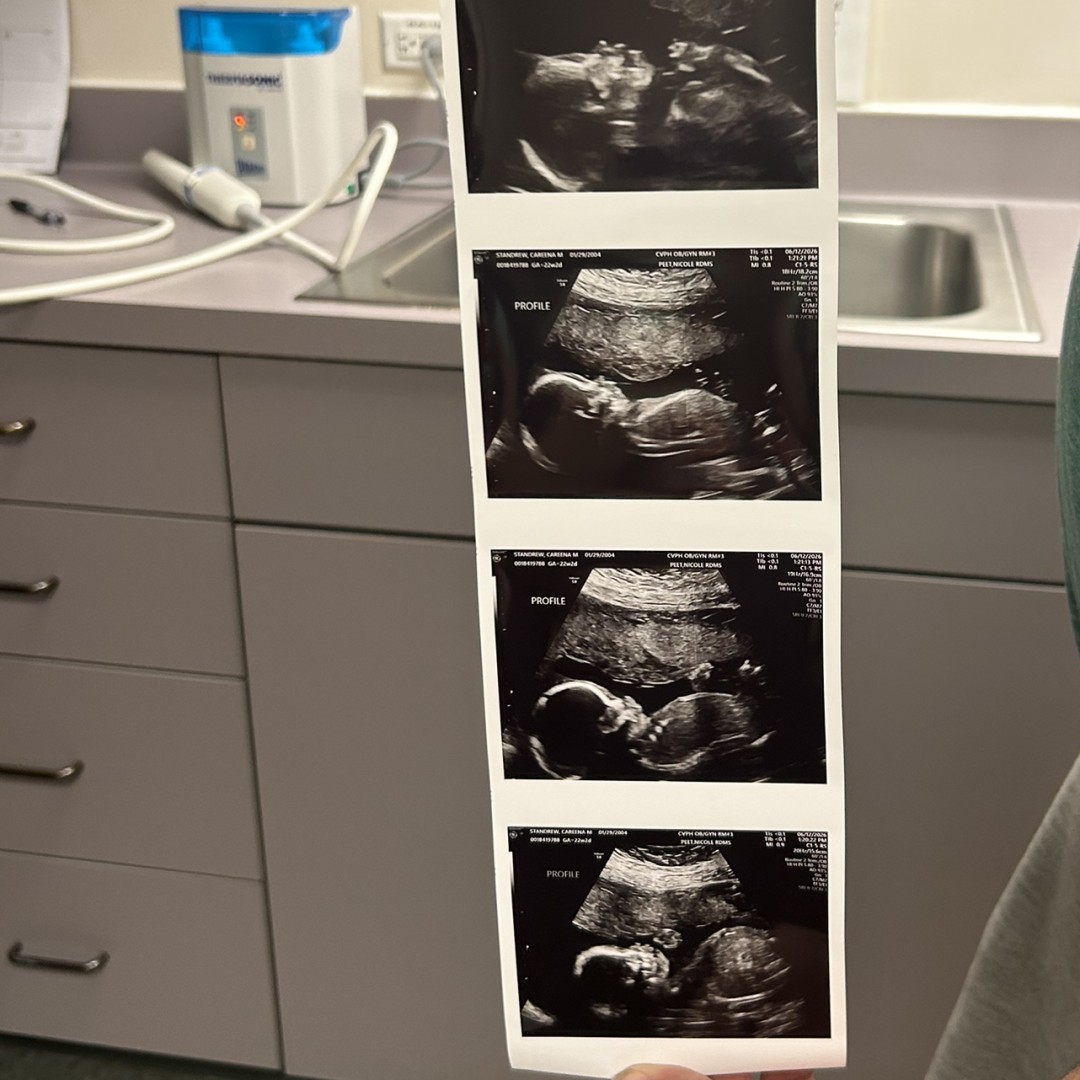 Photo shared by Careena for their Babylist baby registry.