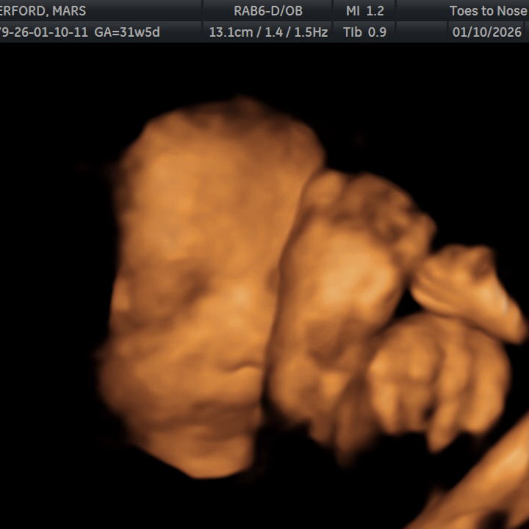 Photo shared by Mars for their Babylist baby registry.