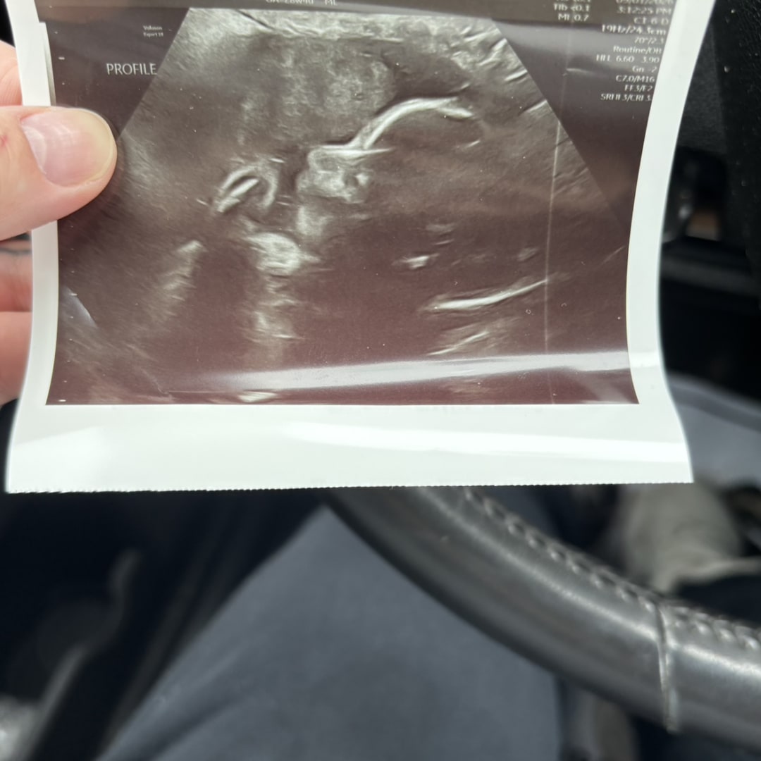 Photo shared by Cora for their Babylist baby registry.