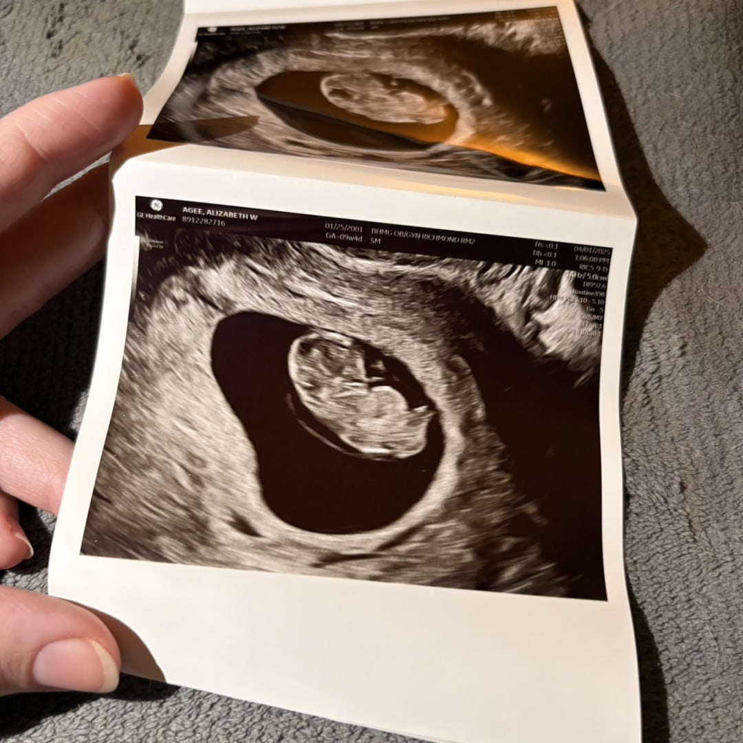 Photo shared by Alizabeth for their Babylist baby registry.