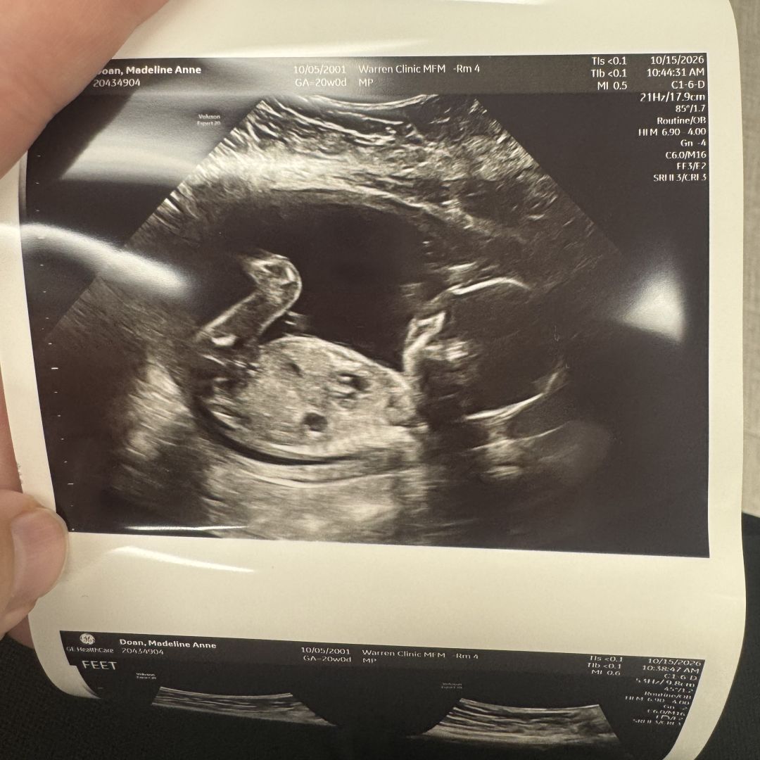 Photo shared by Maddie for their Babylist baby registry.