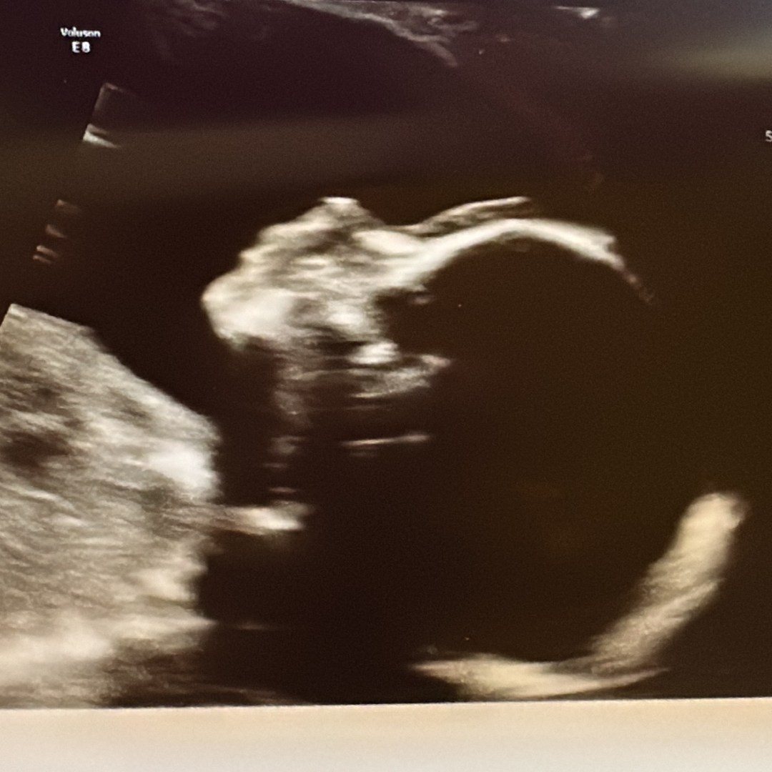 Photo shared by Kary for their Babylist baby registry.