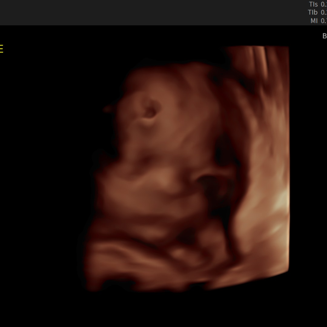 Photo shared by Gabriella for their Babylist baby registry.