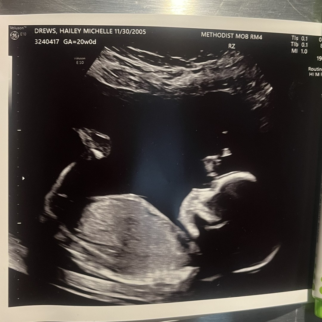 Photo shared by Hailey for their Babylist baby registry.