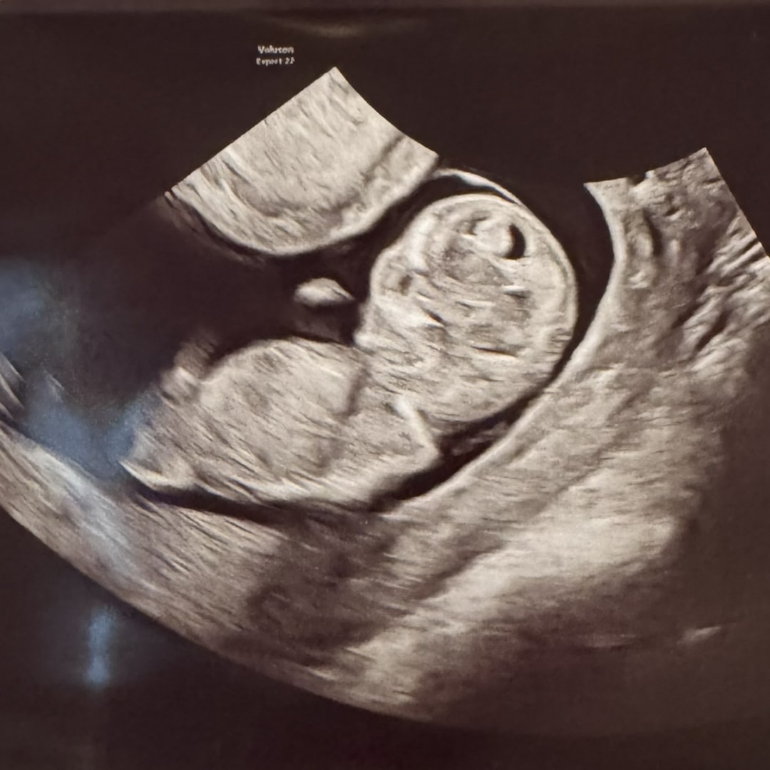 Photo shared by Rachel for their Babylist baby registry.