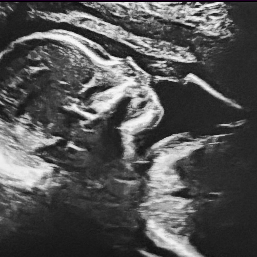 Photo shared by Rachel for their Babylist baby registry.