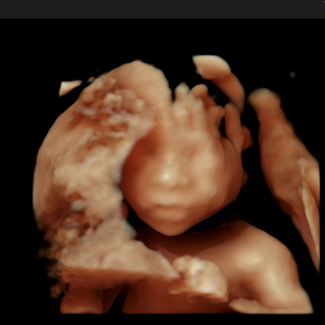 Photo shared by Rachel for their Babylist baby registry.