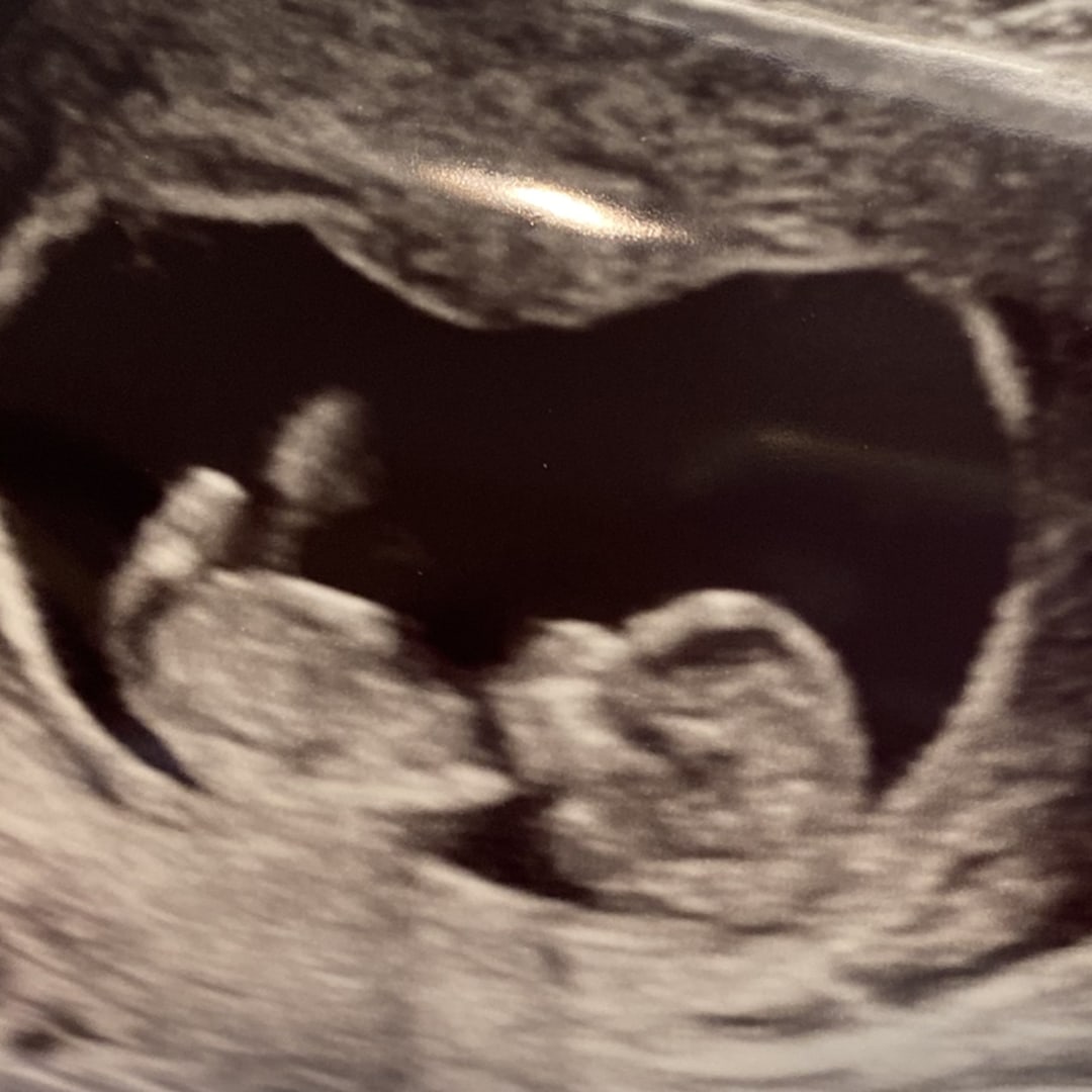 Photo shared by Jessica for their Babylist baby registry.