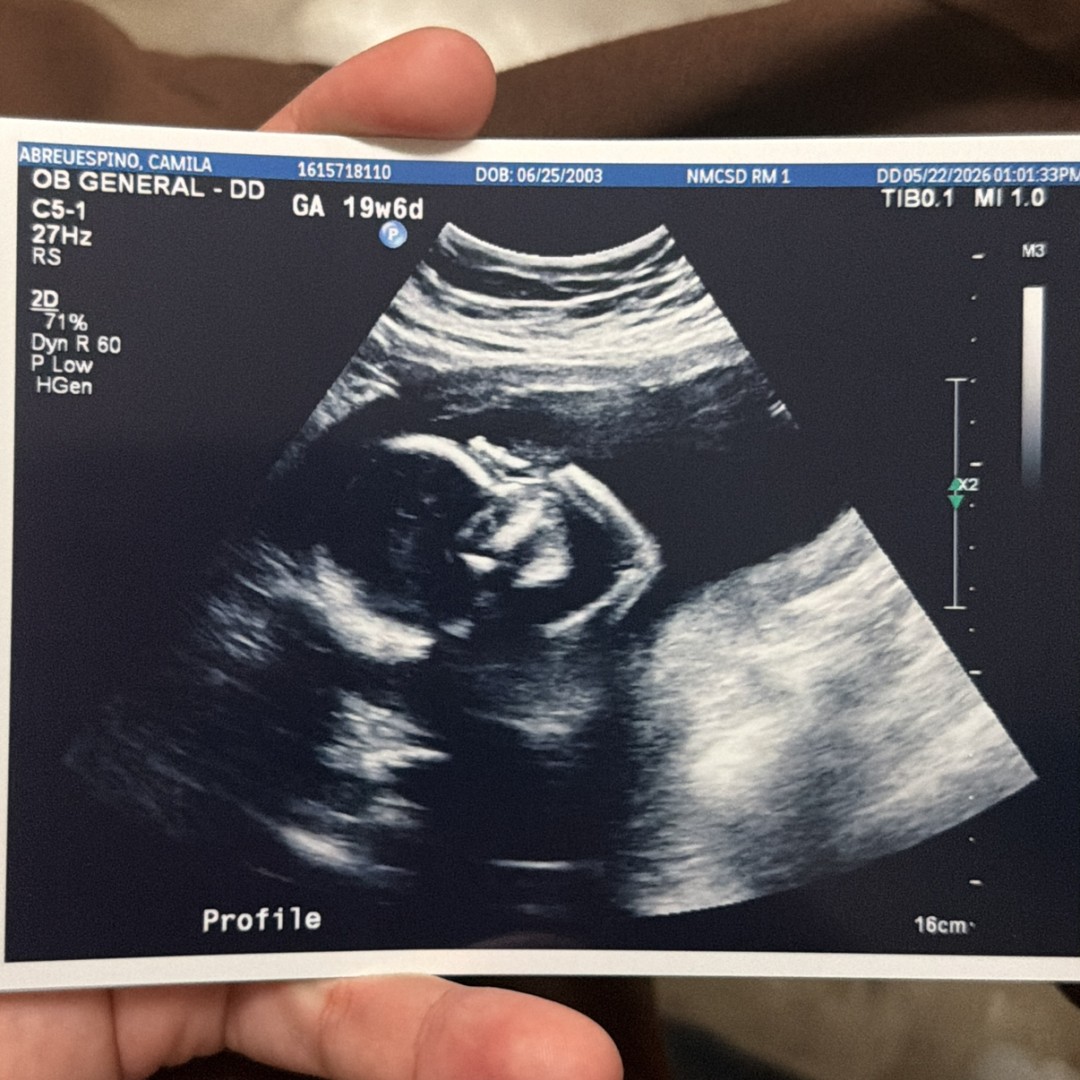 Photo shared by Camila for their Babylist baby registry.