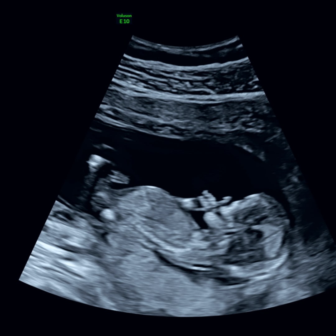 Photo shared by Cassie for their Babylist baby registry.