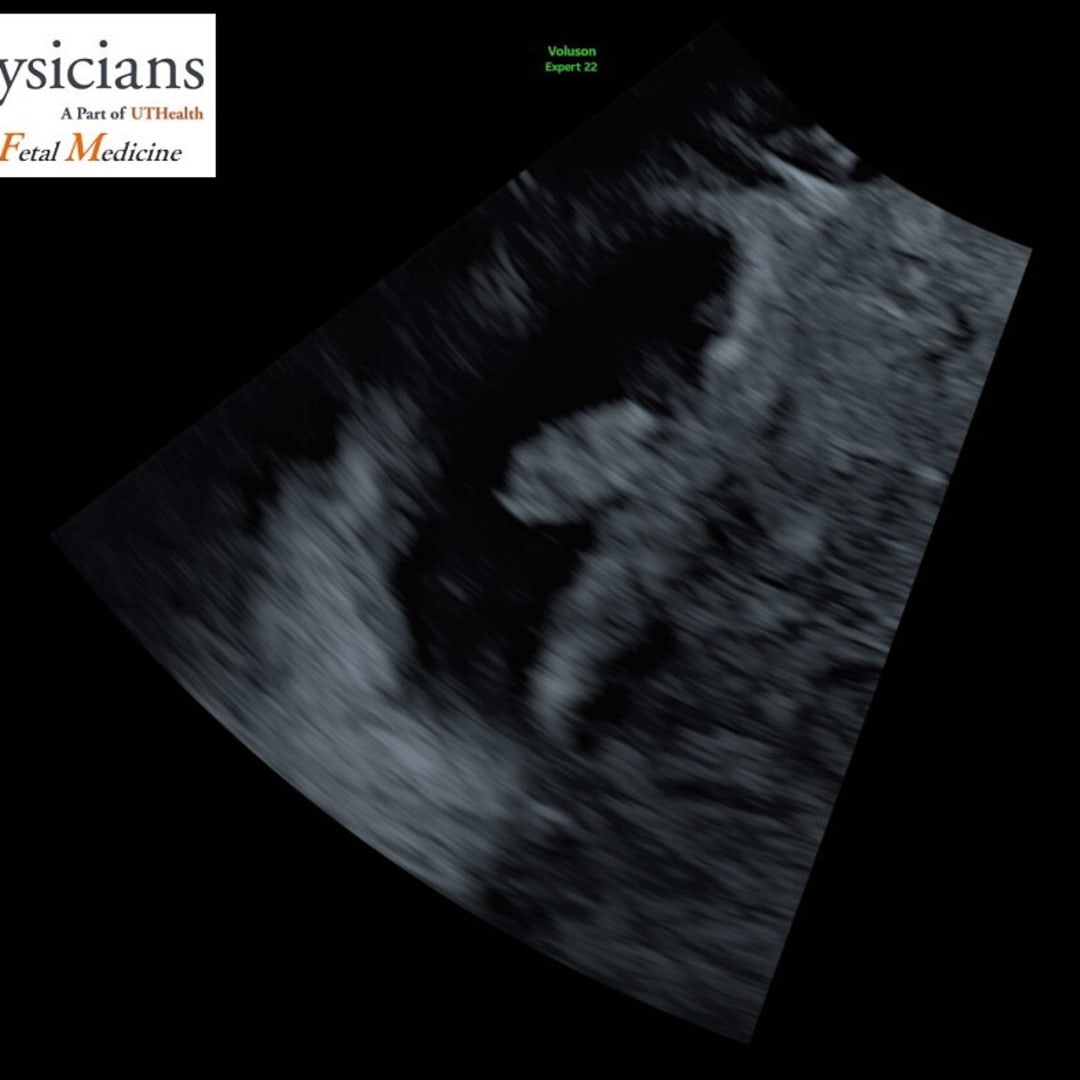 Photo shared by Jalyssia for their Babylist baby registry.
