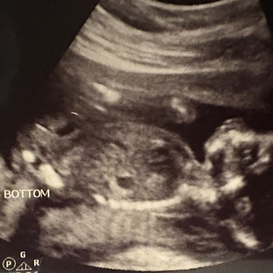 Photo shared by Alie for their Babylist baby registry.