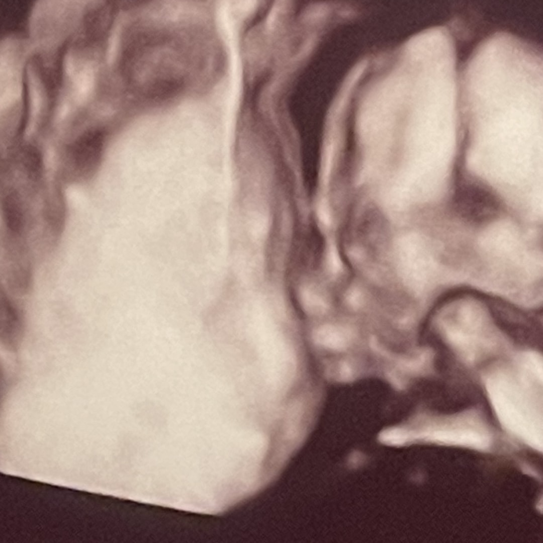 Photo shared by Gracie for their Babylist baby registry.