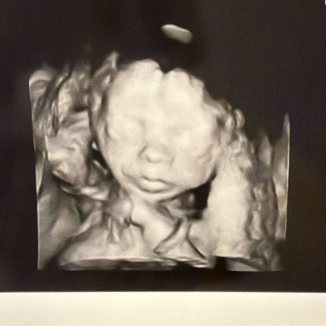 Photo shared by Carlee for their Babylist baby registry.