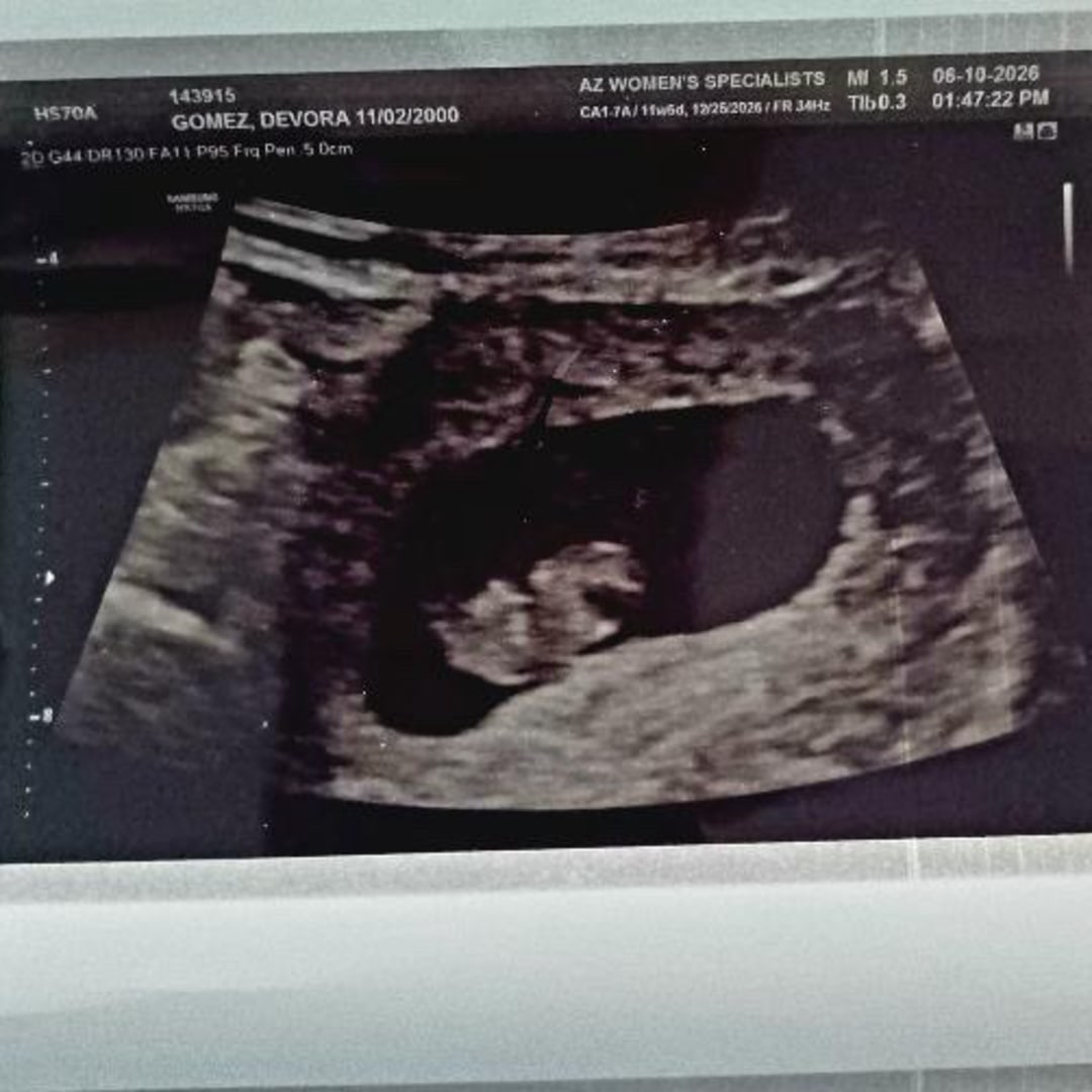Photo shared by Devora for their Babylist baby registry.