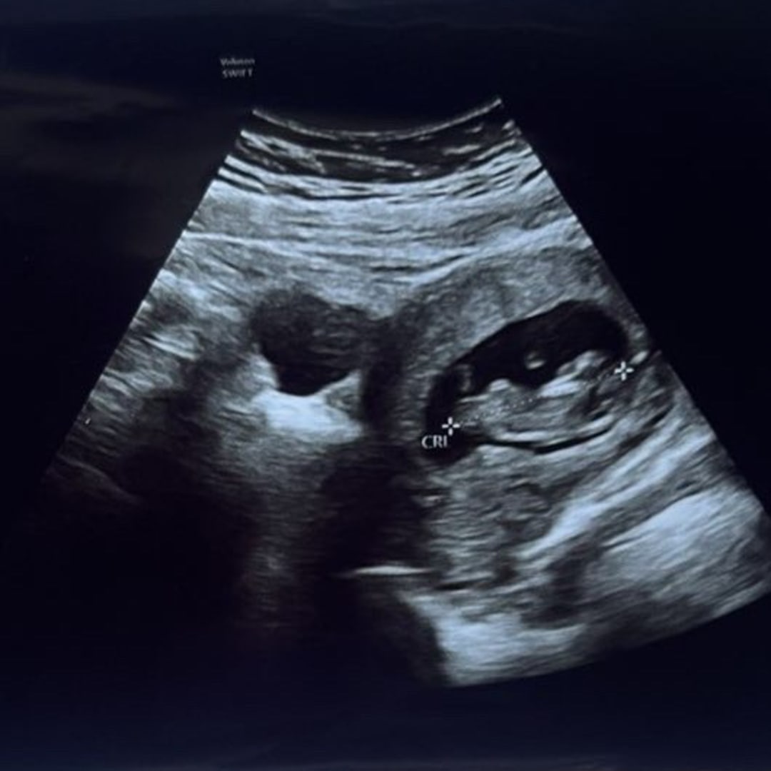 Photo shared by Trenitie for their Babylist baby registry.