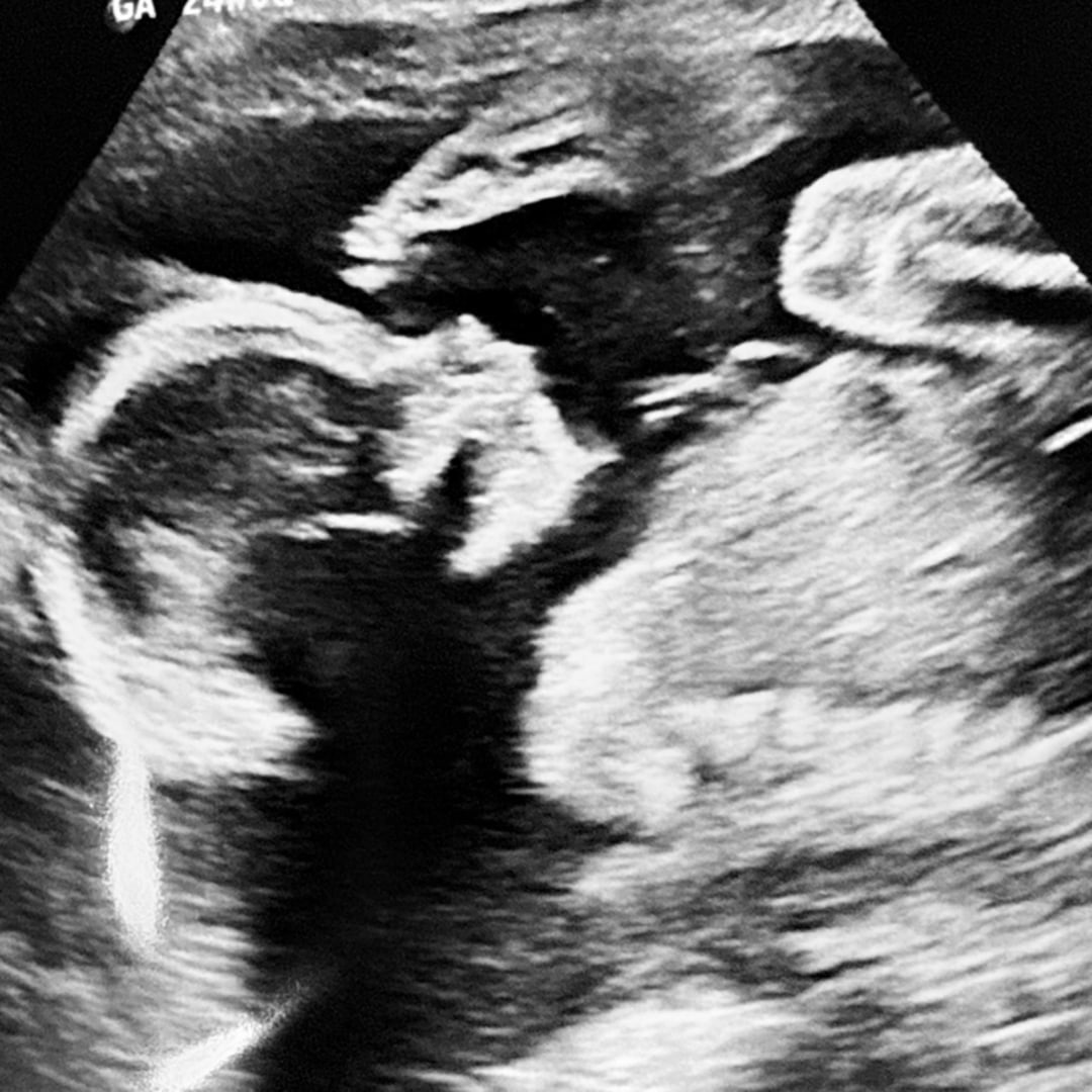 Photo shared by Alexia for their Babylist baby registry.