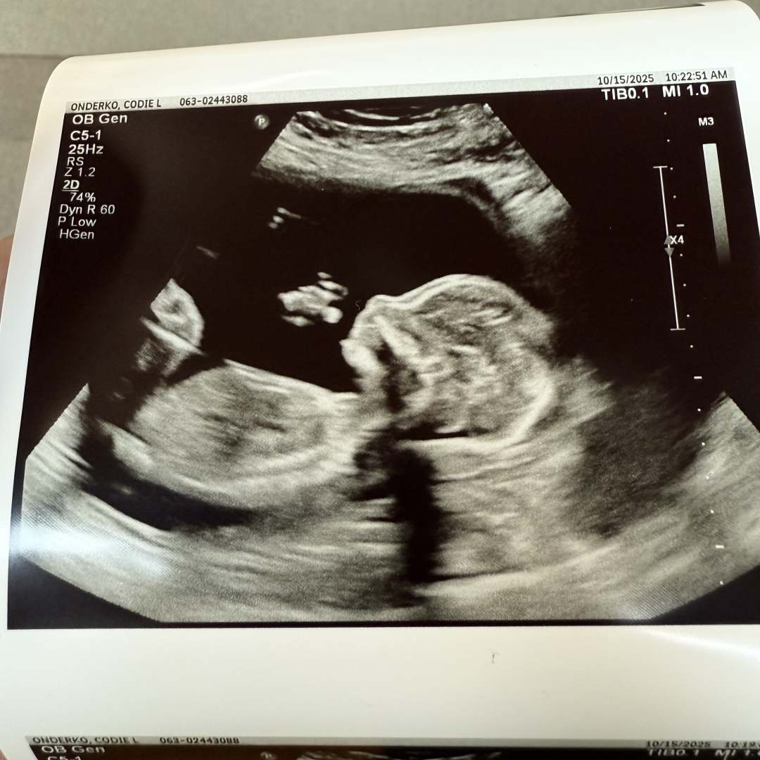 Photo shared by Codie for their Babylist baby registry.