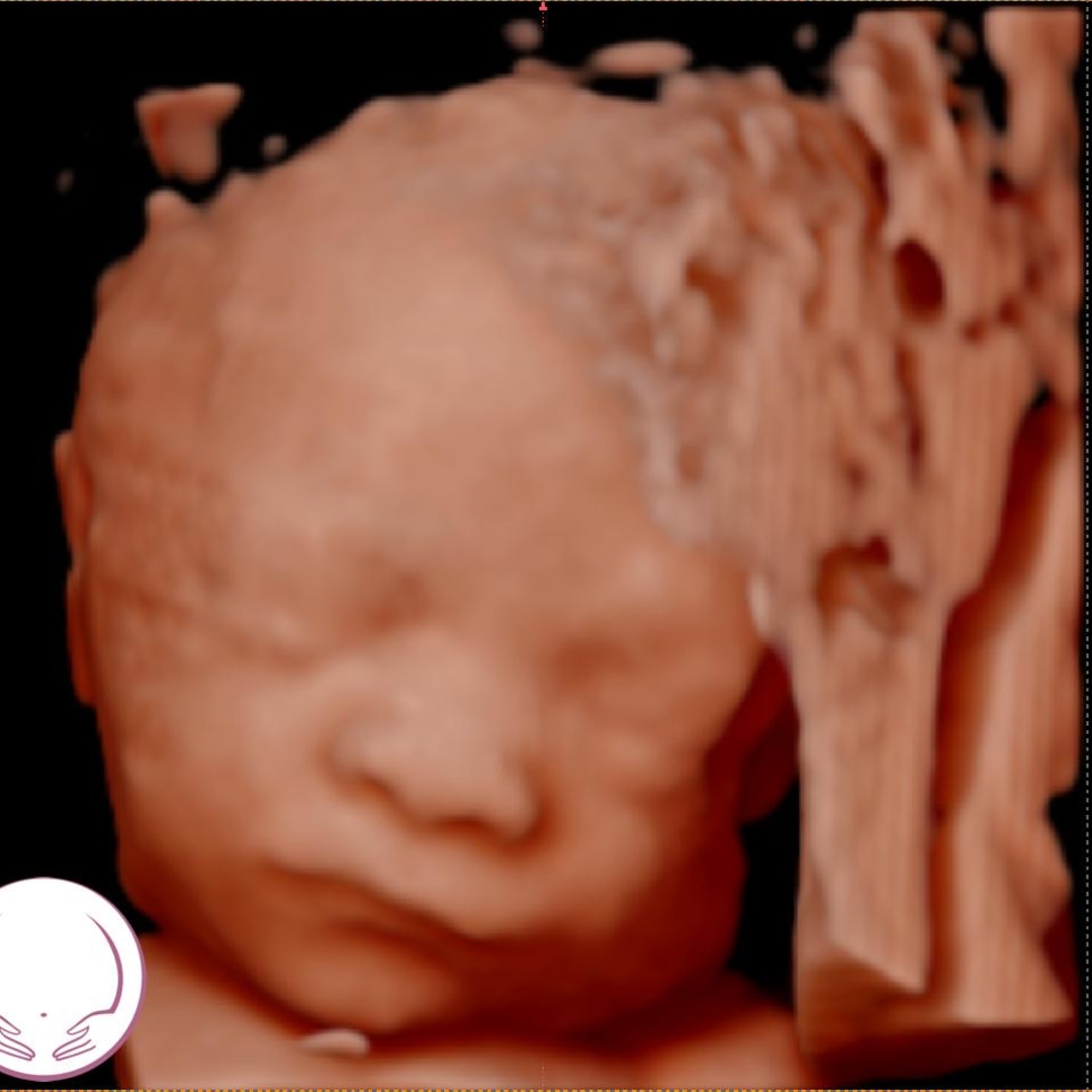 Photo shared by Sierra for their Babylist baby registry.
