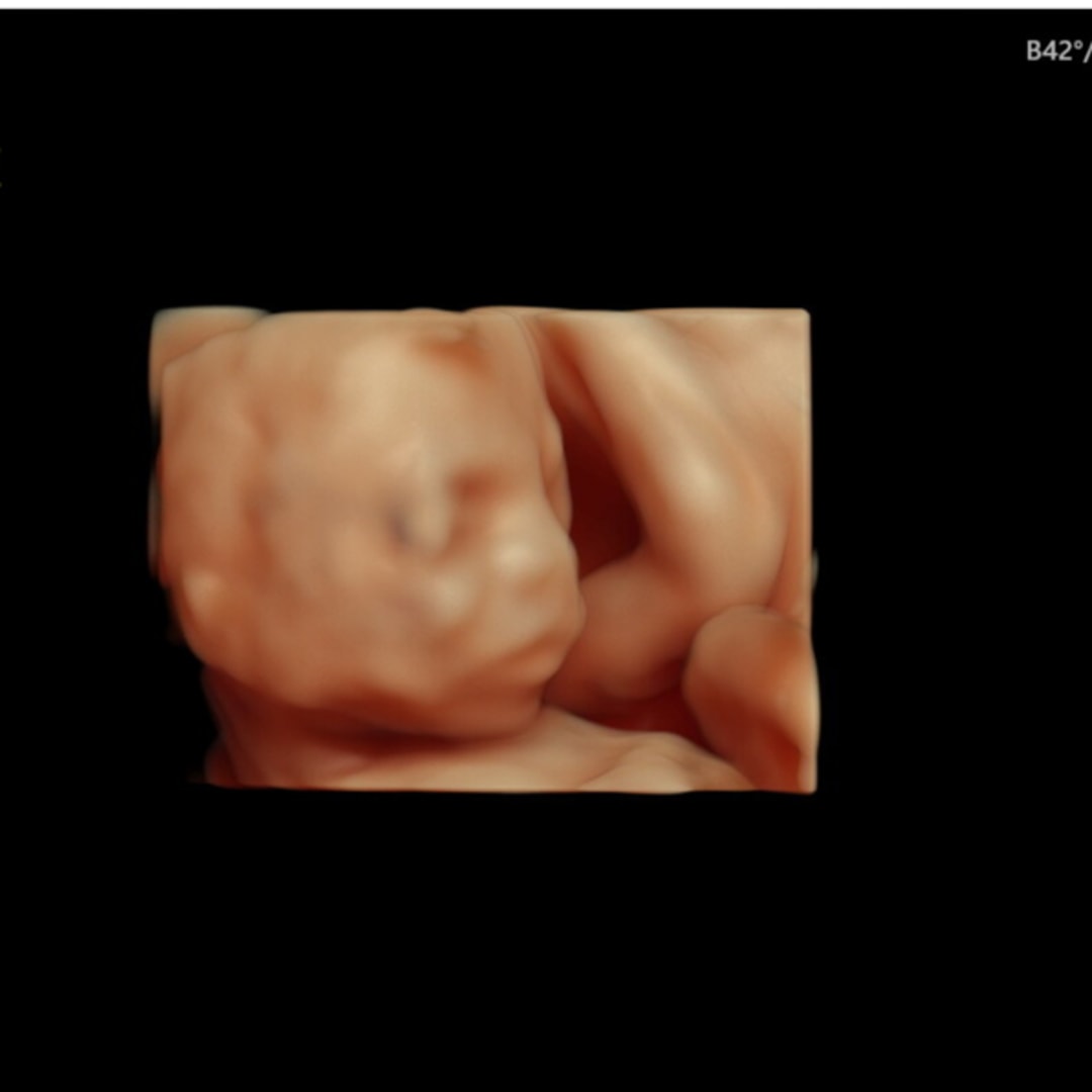 Photo shared by Mollie for their Babylist baby registry.