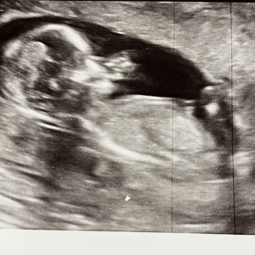 Photo shared by Sandra for their Babylist baby registry.