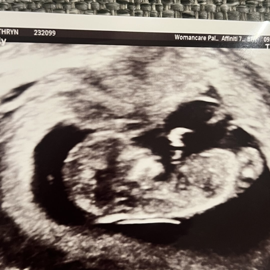 Photo shared by Katie for their Babylist baby registry.