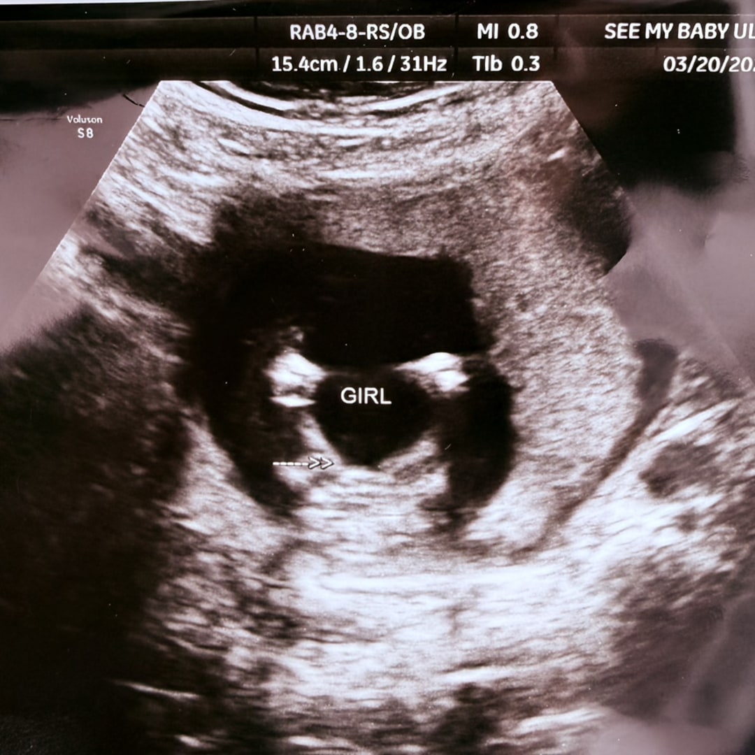 Photo shared by Duvrashka for their Babylist baby registry.