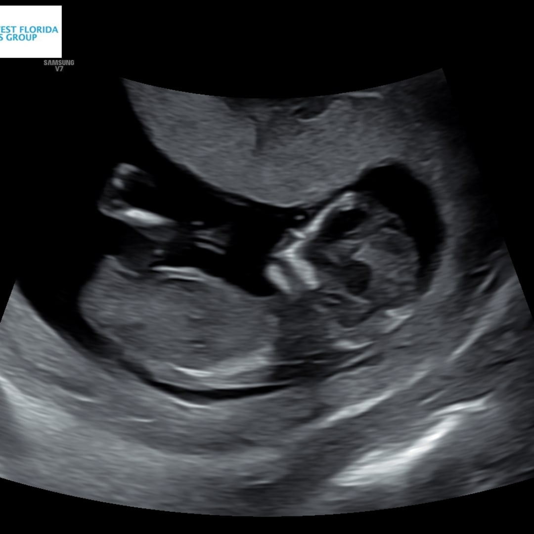 Photo shared by Ava for their Babylist baby registry.