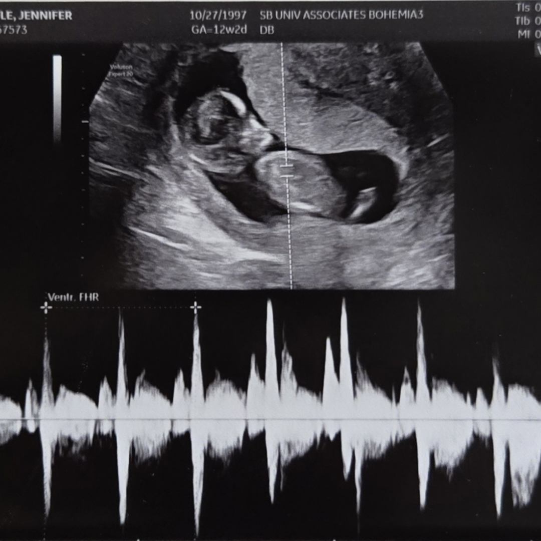 Photo shared by Jen for their Babylist baby registry.